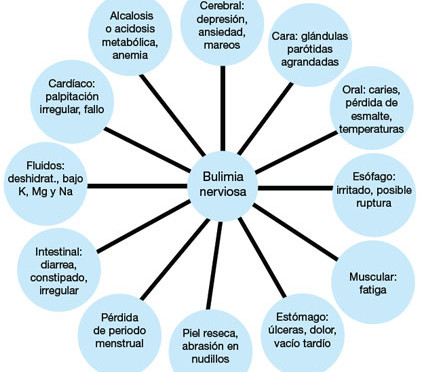 Cuadros sinópticos sobre bulimia | Cuadro Comparativo