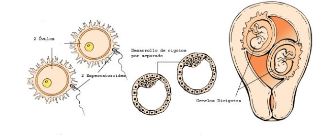 Mellizos O Gemelos: Diferencias En Cuadros Sinópticos Y Comparativos ...