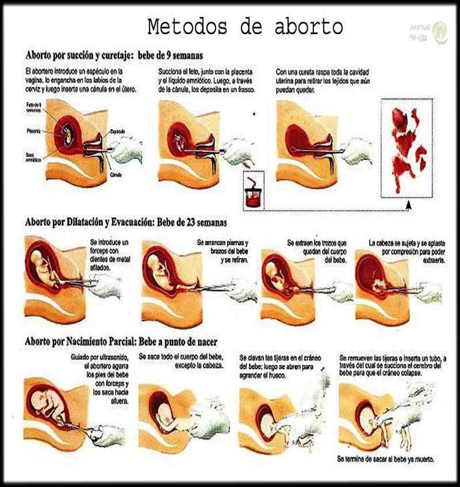 abortoimage007