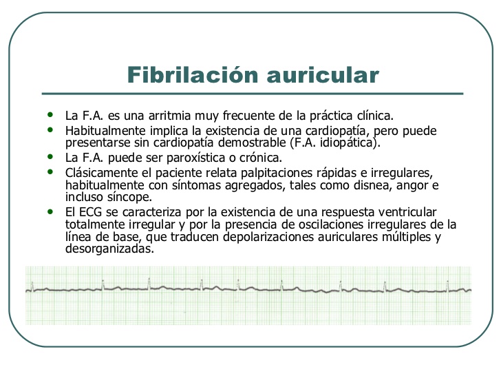 arritmias-cardiacas-medicos-rte-graduacin-43-728