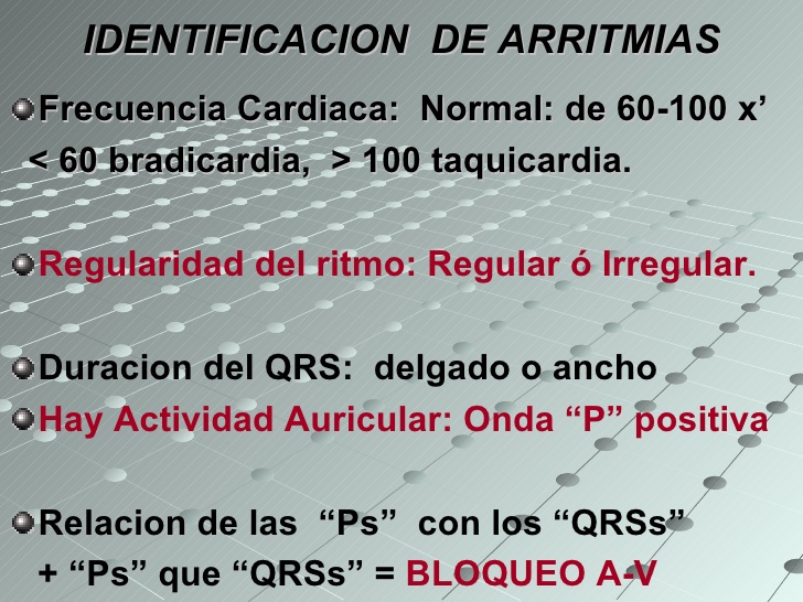 arritmias-diaagnostico-rpido-y-fcil-6-728