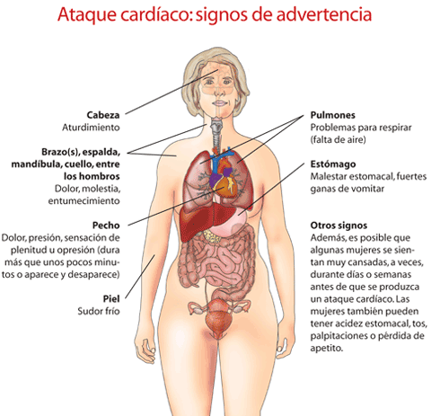 parosigns-of-heart-attack-spanish