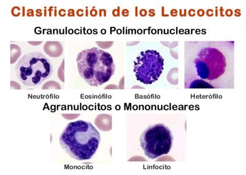 Cetosis leucocitos orina